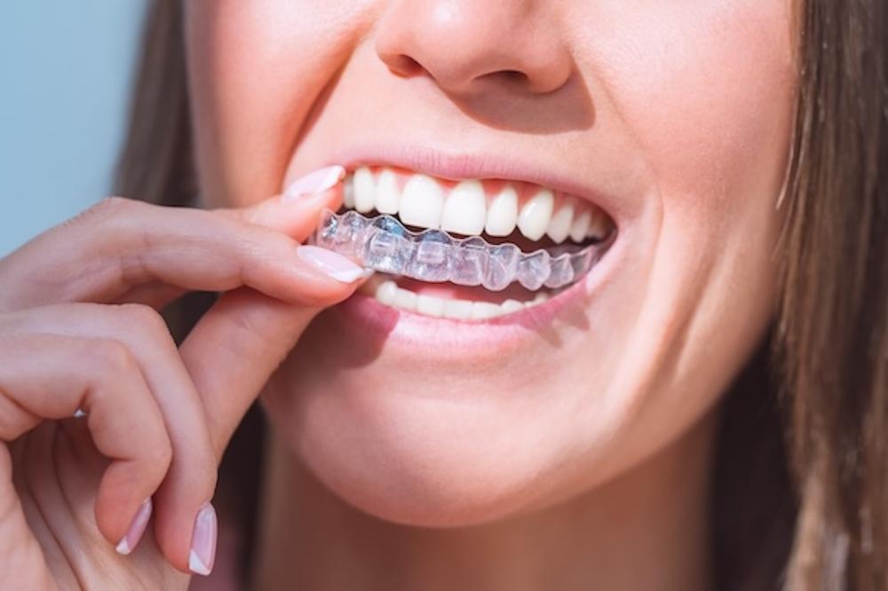 woman holding suresmile clear aligners