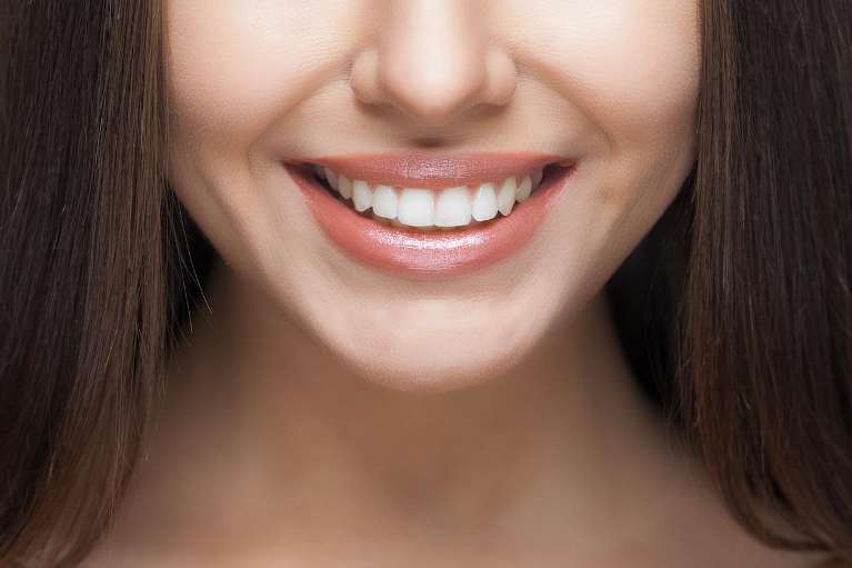 smile makeover in Wilbraham MA